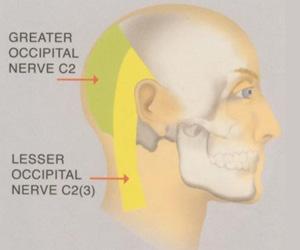 -Irritazione da: traumatismi, stress fisici, contrazioni ripetute dei muscoli del collo,