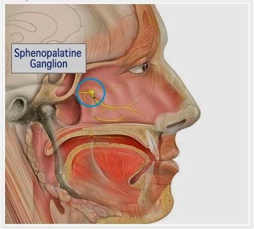 Sindrome di Sluder -Da stimoli diretti o riflessi sull arteria mascellare interna con interessamento del ganglio