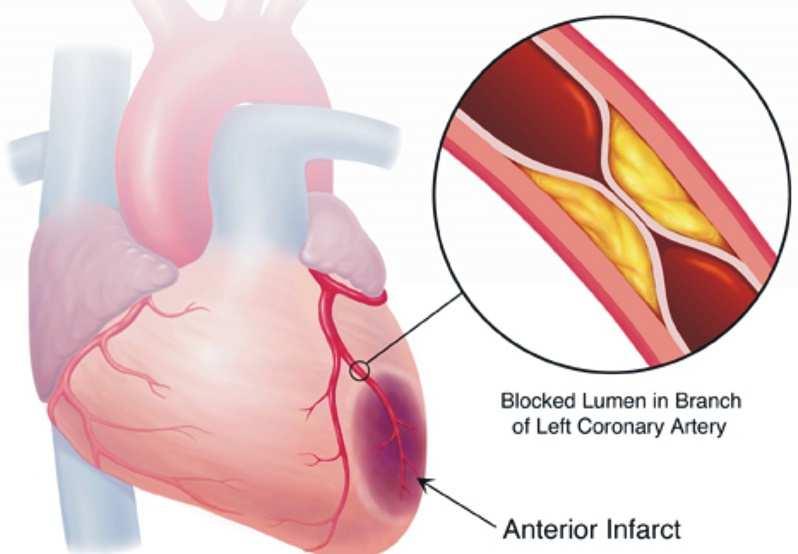 Il sangue arterioso diventa così sangue venoso: attraverso i capillari venosi raggiunge le vene e si dirige nuovamente al cuore, raccogliendosi nelle vene cave che lo riportano nell'atrio destro, da