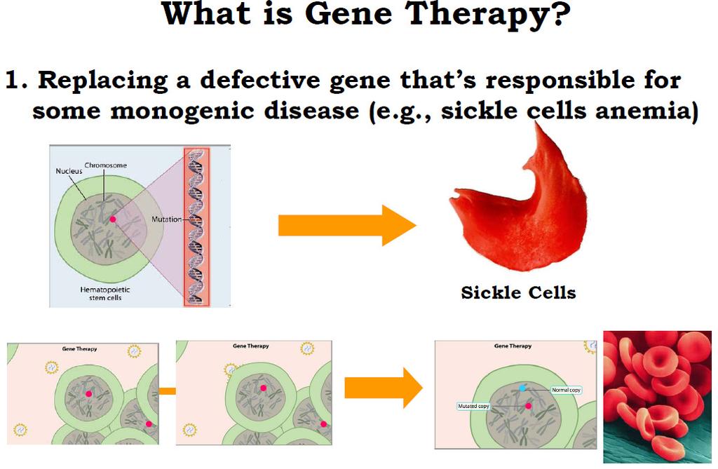 Sostituzione o riparo gene difettivo responsabile della malattia monogenica (es. anemia falciforme) Cos è la terapia genica E suddivisibile in tre categorie: 1.