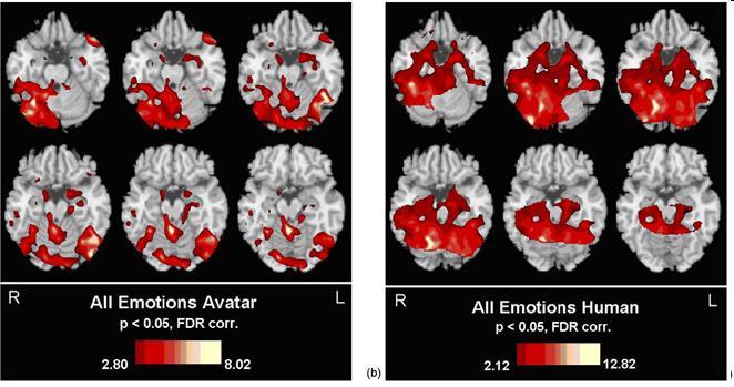 Tecniche di neuroimmagine: fmri Sinistra: reazioni ad avatar (facce 3D virtuali), destra: reazioni a volti reali.