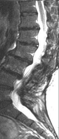 lombosacrale ha consentito di ottenere immagini fini delle varie strutture oggetto