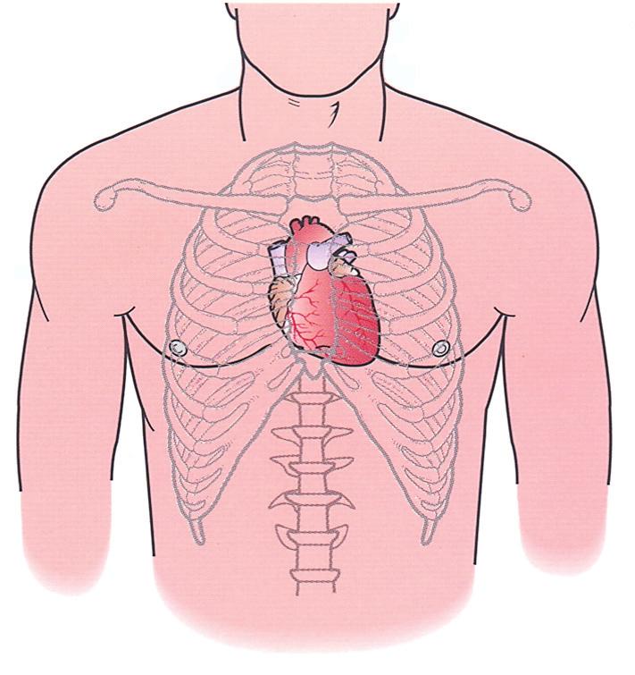 Anatomia del cuore Il cuore, il più grande muscolo, localizzato nel mediastino, è la struttura centrale del sistema cardiovascolare.