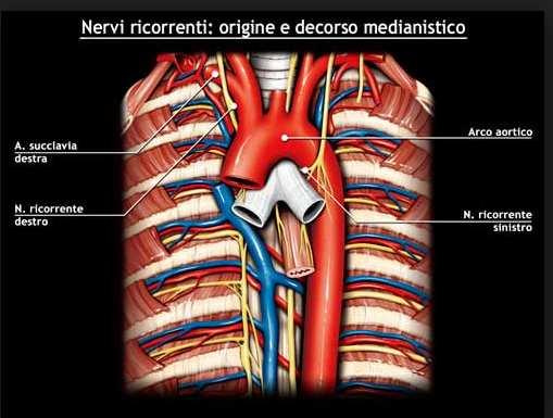 intratoracico di GM: alterazioni del decorso anatomico di RLN (dx> sin) e dislocazioni paratiroidi NIM Evitare: