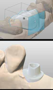 Fondata su un decennio di sviluppo di sistemi CAD per laboratori dentali, DWOS Easy Mode si basa sull'ultima tecnologia innovativa all'interno di un'interfaccia utente ottimizzata e su strumenti di