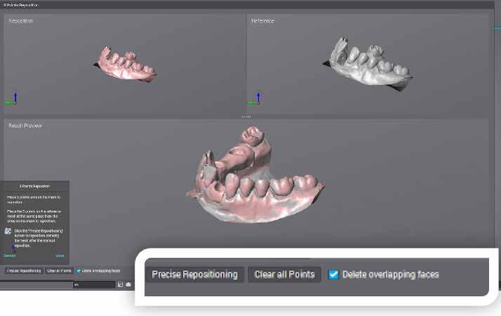 Modellazione Bite Tutori Nel modulo di modellazione