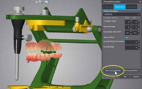 Articolatore Virtuale Trasferire la posizione di occlusione dall'articolatore virtuale alla modellazione. 1. Impostate l'occlusione nell'editor dell'articolatore virtuale 2.