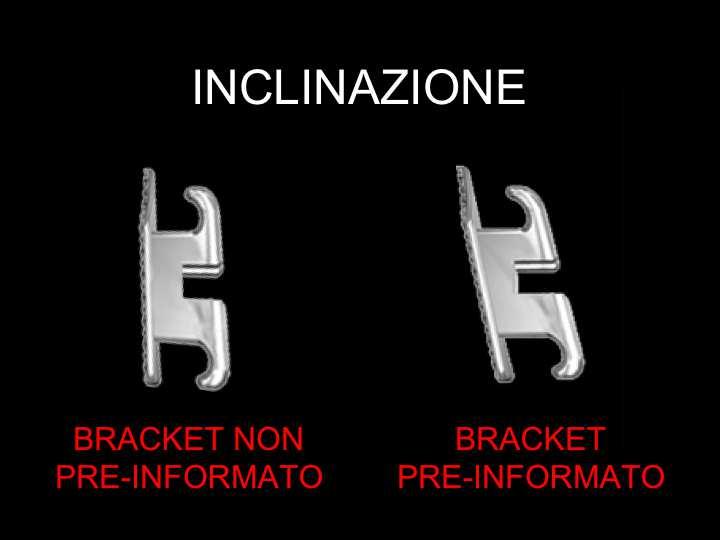 PRE-INCLINAZIONE (TORQUE 2 ) Lo slot presenta un inclinazione, specifica per ogni dente, rispetto alla base del bracket stesso. Evita la necessità di pieghe di III ordine sull arco.