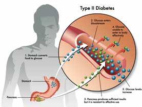 Che cos è il diabete?