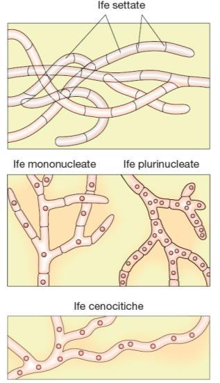 mono- o pluri-nucleata).