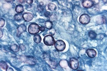 MICETI DIMORFI Possono assumere due morfologie (lieviti o muffe) a seconda delle condizioni ambientali (temperatura, nutritive, pressione di CO 2, potenziale