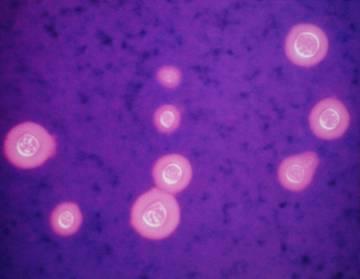 CRYPTOCOCCUS NEOFORMANS L unico fungo provvisto di capsula