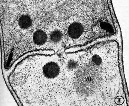 In Fusarium oxysporum membrane-bound organelles called WORONIN BODIES: composed of protein; remain close to the septal pore and tend not to be disturbed by the cytoplasmic streaming taking place;