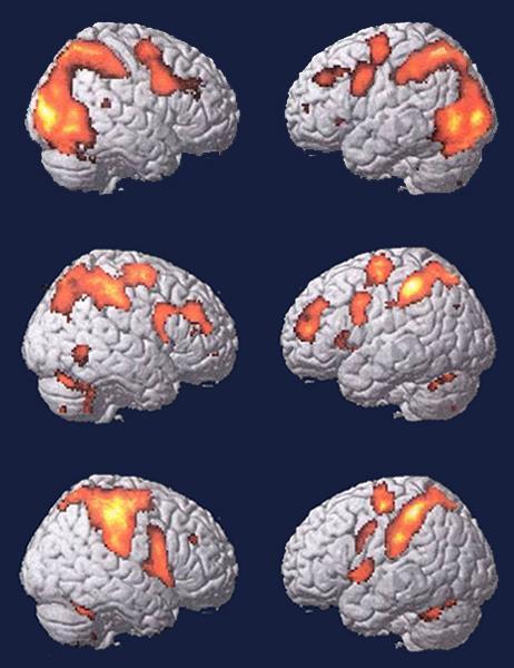 sistema specchio L imitazione è molto importante nell apprendimento di