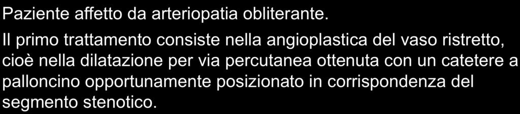 percutanea ottenuta con un catetere a palloncino