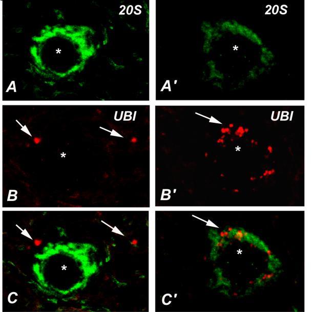 Diminuzione del proteasoma nei motoneuroni di topi con la SLA Prima 10 weeks della