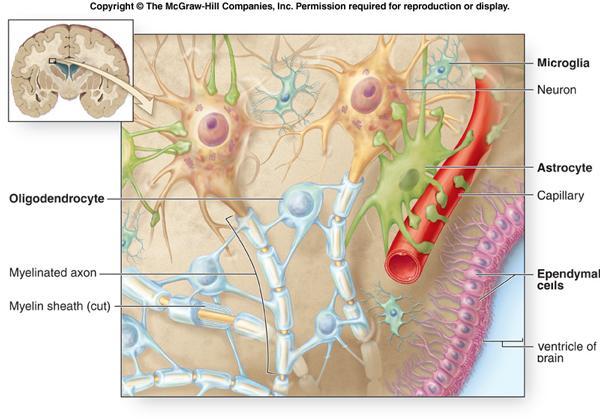 Le malattie neurodegenerative sono caratterizzate dalla progressiva perdita di neuroni (la materia