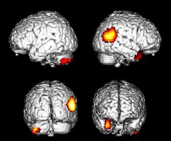 Sommario Struttura del Sistema Nervoso Centrale Il linguaggio Le trasformazioni visuo-motorie I mirror neurons Esempio di processing corticale 33/51 Dalla neuro-anatomia alla funzione Connessionismo