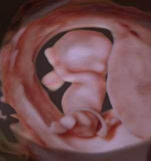 Ecografia morfologica nel primo trimestre uno studio dell anatomia del feto nel primo trimestre è fattibile e consente la diagnosi della maggior parte delle malformazioni (80%) la diagnosi