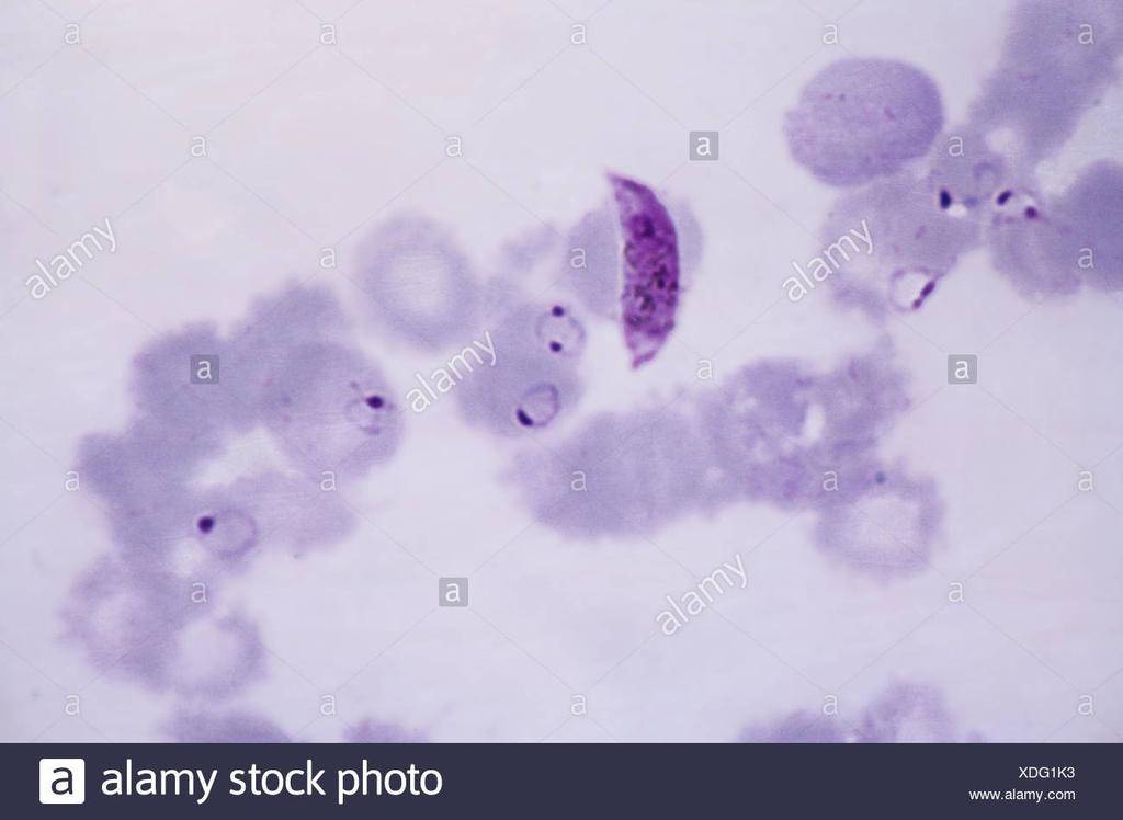 Cosa provoca la MALARIA La malaria è provocata, nell'uomo, da quattro tipi di Plasmodi: - Plasmodium falciparum, responsabile della malaria maligna o terzana; - Plasmodium vivax, responsabile della