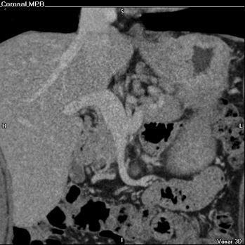 Da 16 canali in su (imaging