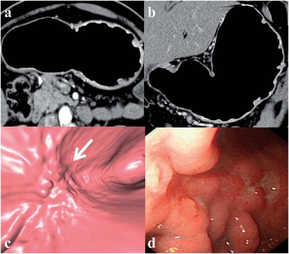 endoscopica.