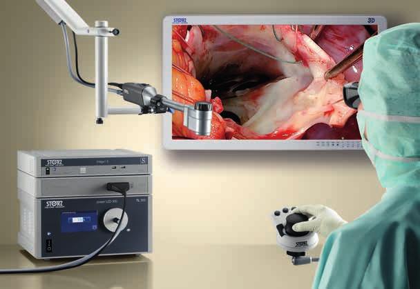 VITOM 3D Visualizzazione 3D per la microchirurgia e la chirurgia aperta Il sistema VITOM 3D rappresenta una soluzione rivoluzionaria per la visualizzazione di interventi microchirurgici e di