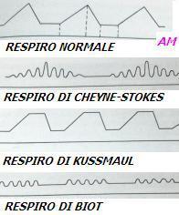 ACUTO Stretching Barocettori