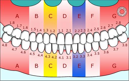 Video: "Spazzolamento inferiore interno" (linguale) Per essere sicuri di non trascurare nessuna zona della bocca, in ambedue le arcate dentarie possiamo distinguere: 7 zone, esterne (vestibolari) e 7