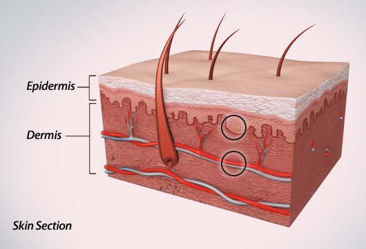 Niacin Induced Flushing Pathway: 2 Separate Sites of Action 1.