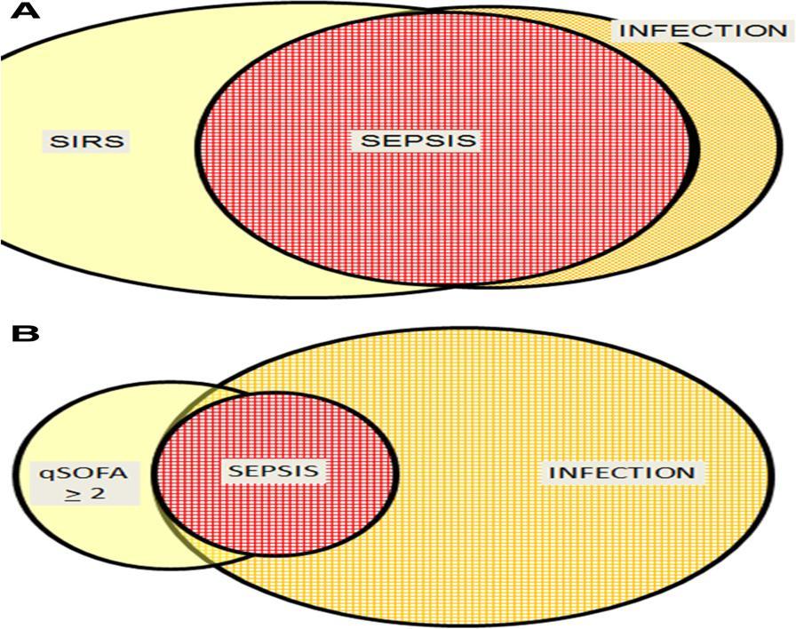 Vincent et al. Critical Care 2016 (20) 210 qsofa does not replace SIRS in the definition of sepsis Jean-Louis Vincent1*, Greg S.