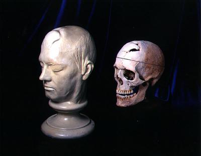 amigdala e giro del cingolo CORTECCIA ORBITOFRONTALE CASO PHINEAS GAGE ( 1800)