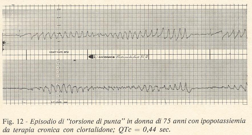 Torsione