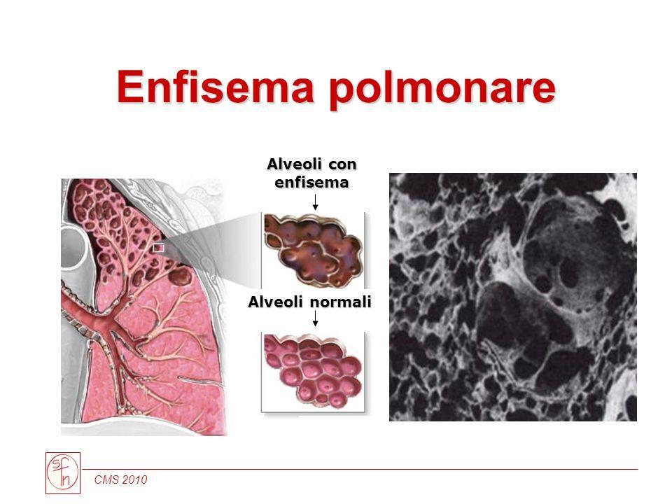 A parità di severità