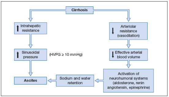 PATOGENESI L ascite cirrotica si sviluppa a causa di: Ipertensione sinusoidale che deriva dal blocco del ritorno venoso epatico secondario alla presenza di noduli rigenerativi e di fibrosi.