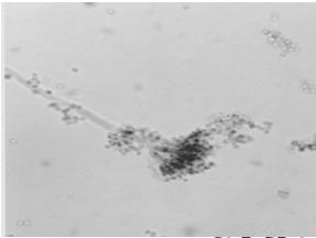 tropicalis Cryptococcus neoformanns Microsporum spp