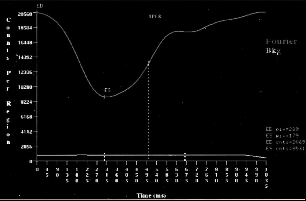 Curva radioattività