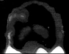 Somministrazione di nuclidi radioattivi e