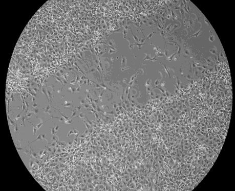 Risultati II. La bassa tensione di O 2 nelle cellule non trasformate. A 1% O2 20% O2 PDGF-BB 5 ng/ml B PDGF (ng/ml) 10 ** 5 ** 20% 1% 2 ** 0 50 100 150 200 N cellule Figura 54.