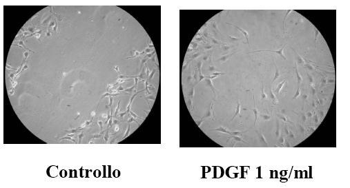 controllo PDGF 1 ng/ml PDGF 2 ng/ml PDGF 5 ng/ml PDGF 30 ng/ml Figura 26.
