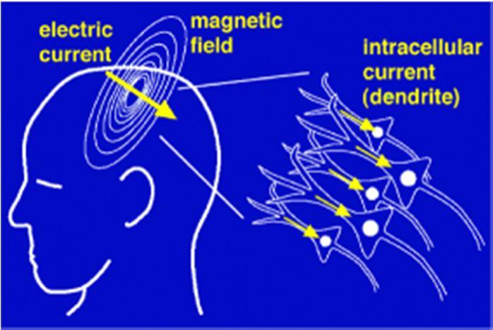 MEG (Magnetoencephalografia; Cohen, 1968) Misurazione delle fluttuazioni di campo magnetico generato dall attività elettrica cerebrale