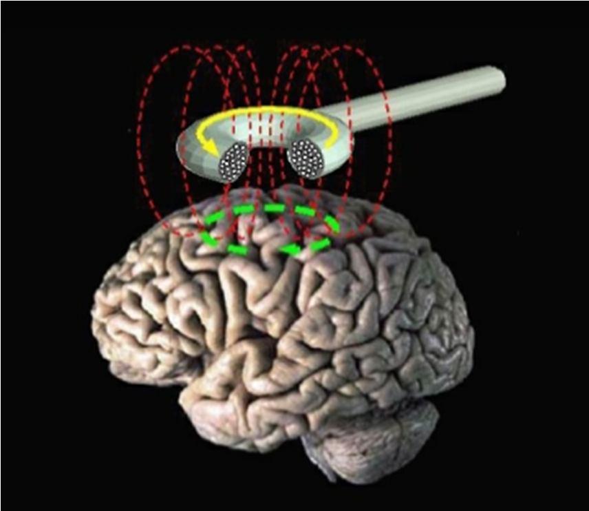 TMS (Transcranial Magnetic Stimulation) Tecnica non invasiva di stimolazione cerebrale Principio di induzione elettromagnetica Virtual lesion (Pascual Leone, Walsh & Rotwell, 2000; Ziemann, 2010)