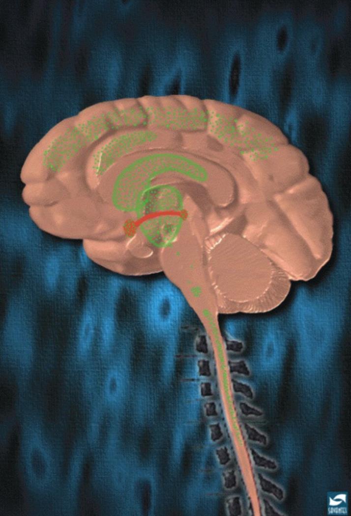 REWARD SYSTEM (in rosso): L Eroina aumenta il rilascio di Dopamina e provoca PIACERE PAIN PATHWAY (in verde): L Eroina aumenta il rilascio di Dopamina e provoca ANALGESIA Dipendenza con/senza