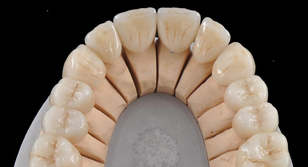 biologica e strutturale dell elemento dentale I materiali restaurativi e le loro caratteristiche cliniche Preparazioni dentali: moderna rivalutazione e classificazione alla luce dei nuovi materiali e