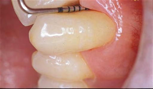 - La diagnostica per immagini in parodontologia e implantologia.