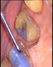 parodontologia: basi biologiche e