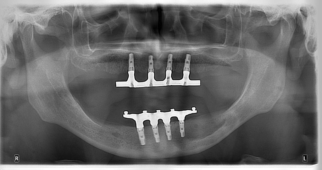 Surgery  DR. A. FALCO antonellofalco@yahoo.