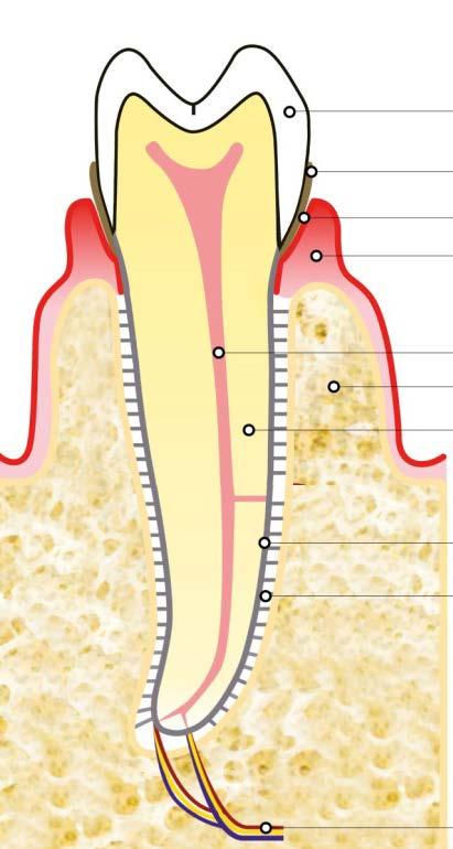 Gengivite, cioè l infiammazione esclusivamente gengivale, ovvero del parodonto superficiale (rettangolo piccolo), senza tasca infraossea e cioè senza
