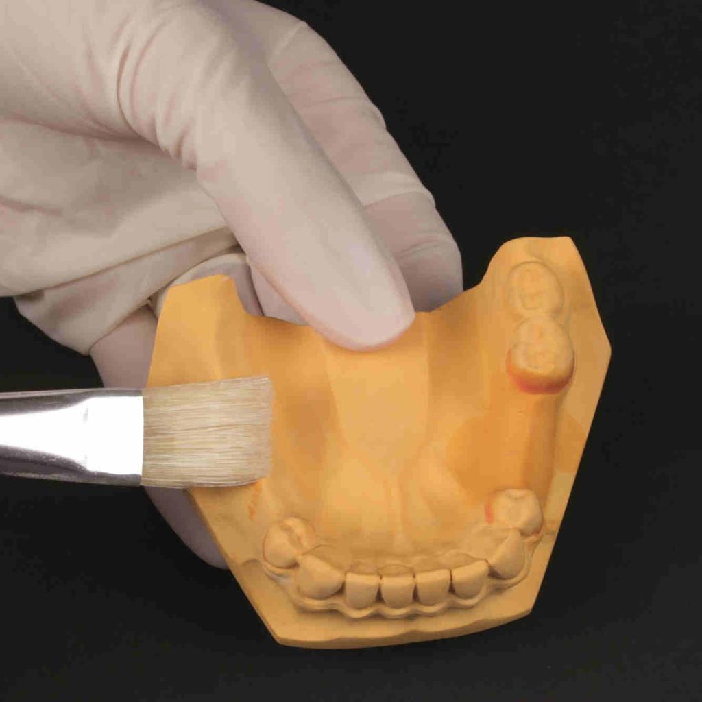 Realizzare una mascherina termostampata sul modello in gesso con la ceratura diagnostica (spessore min. 1,5 mm fino a max.