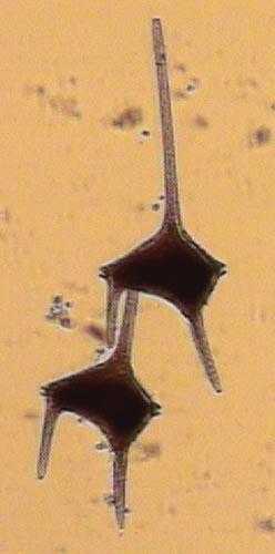 Figura 28. Colonia di Ceratium candelabrum (Dinoflagellata).